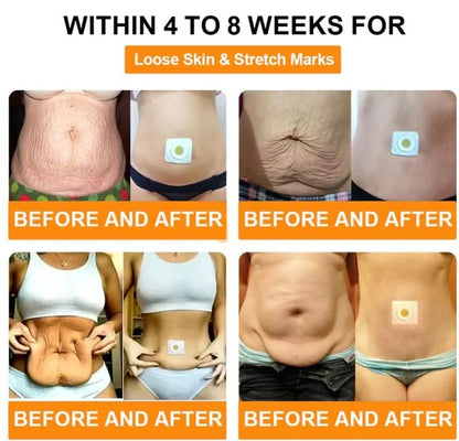 Bee Venom Slimming Patches (Pack of 10)